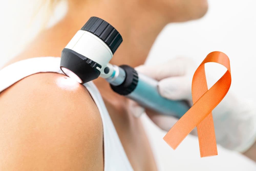 Imagem de uma lupa para olhar a pele de uma mulher e e o símbolo do dezembro laranja